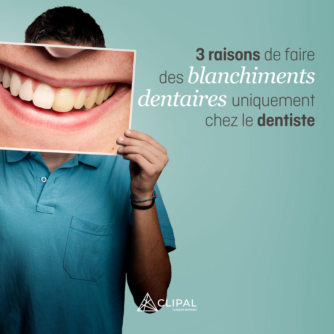 3 raisons pour lesquelles vous devriez effectuer votre traitement de blanchiment des dents uniquement chez le dentiste