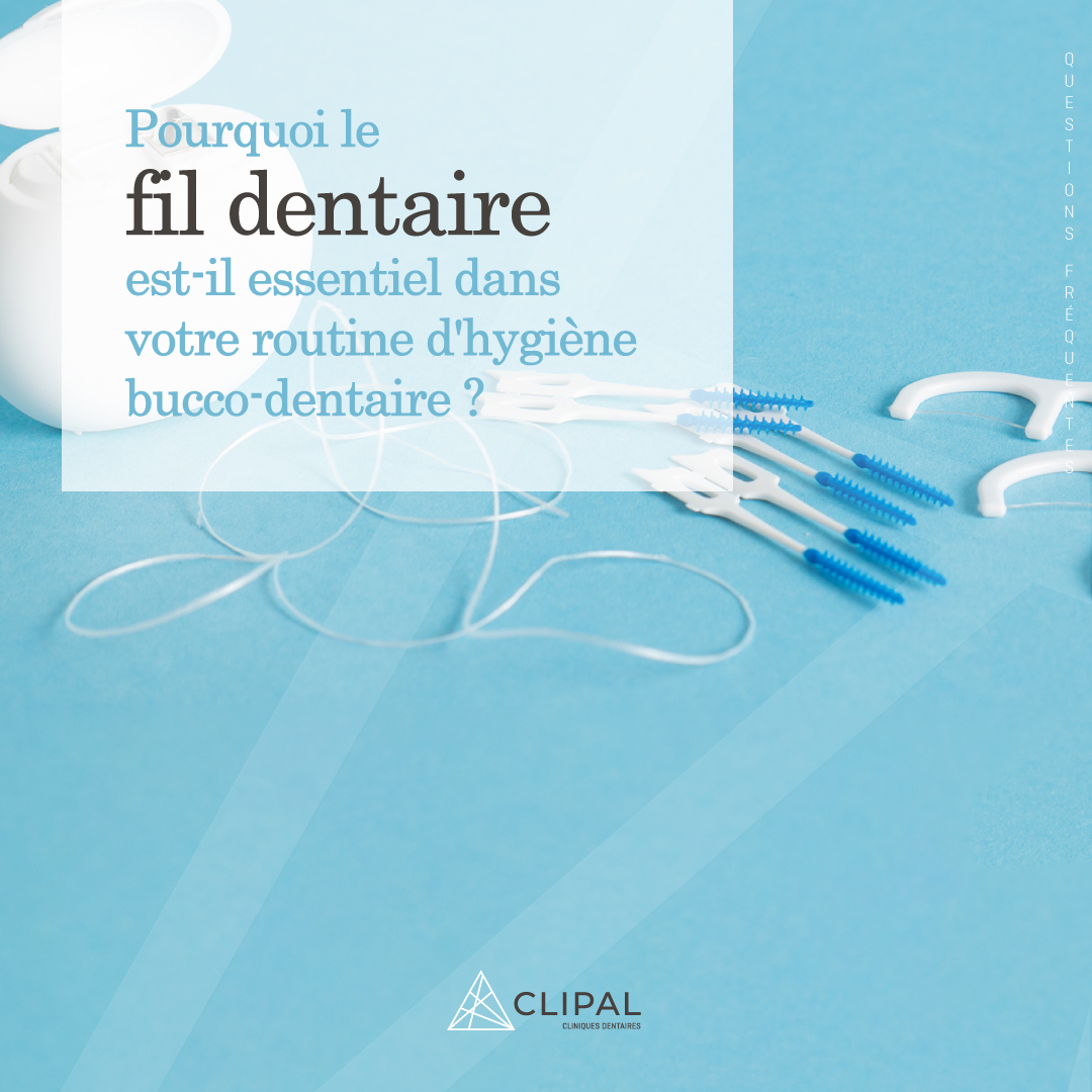 Pourquoi le fil dentaire est-il essentiel dans votre routine d’hygiène bucco-dentaire ?