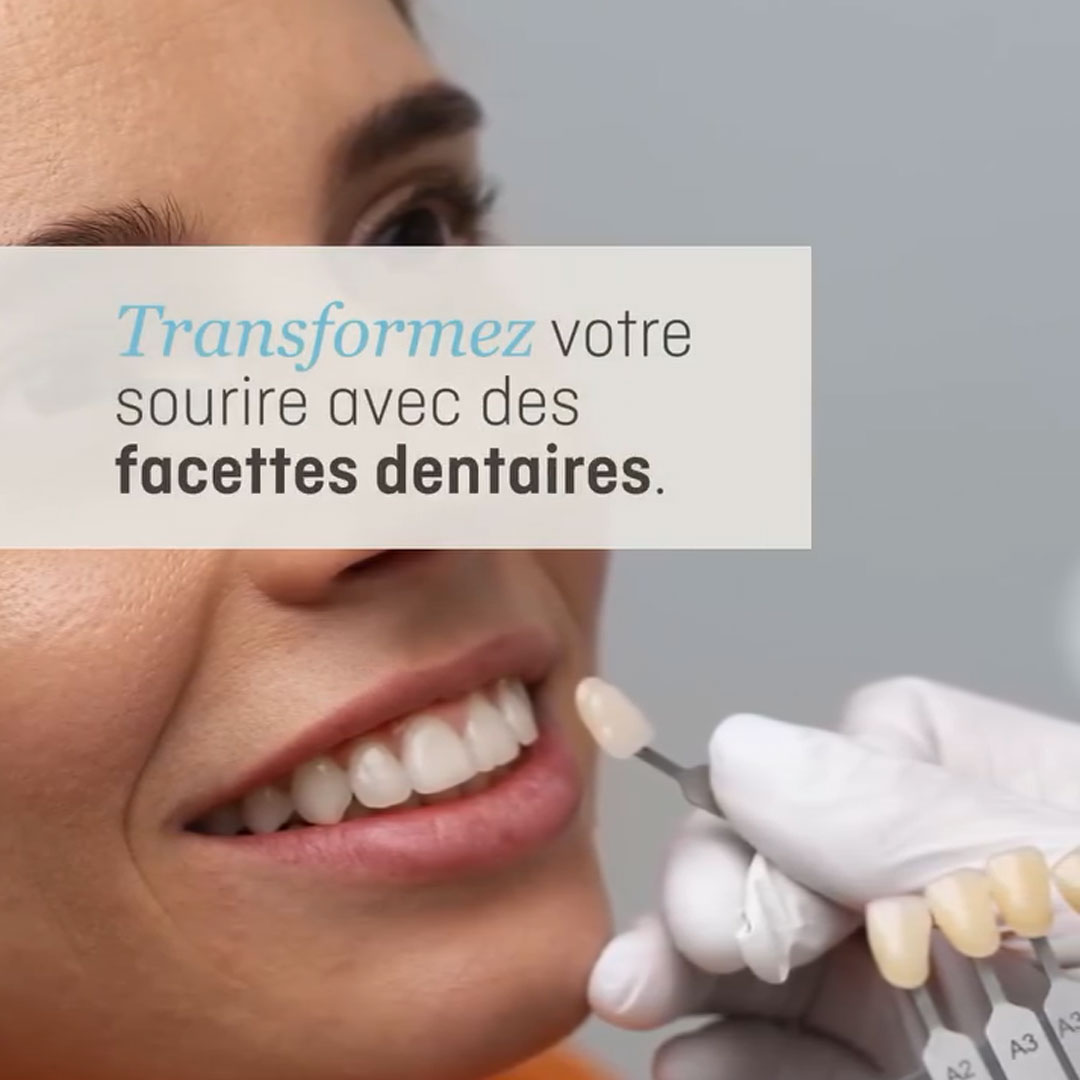 Transformez votre sourire avec des facettes dentaires