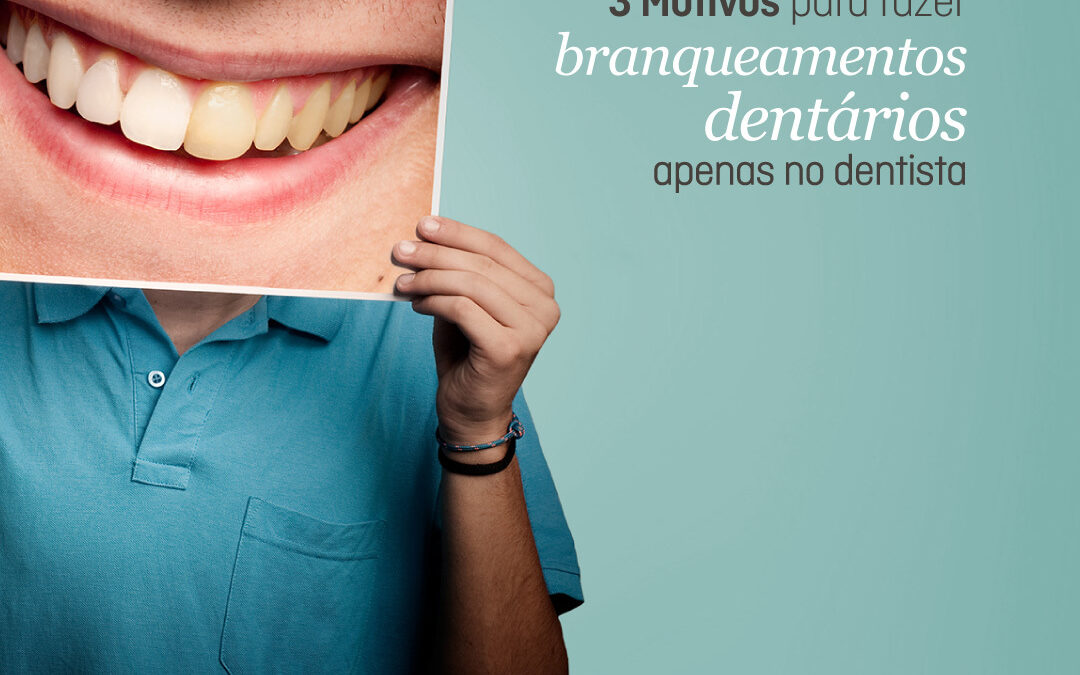 3 Motivos para Fazer Branqueamentos Dentários Apenas no Dentista