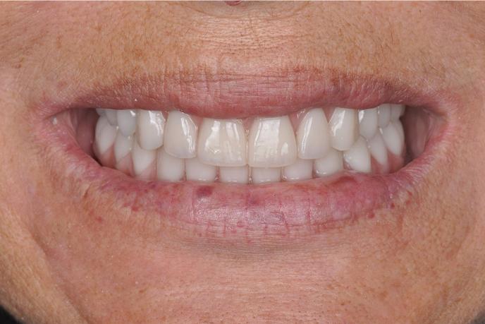 caso-clinico-2-depois