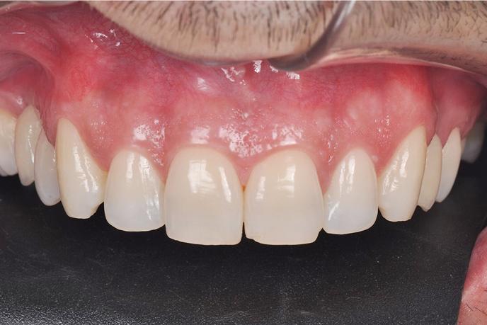 caso-clinico-6-depois