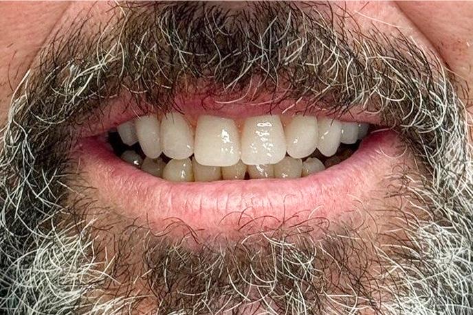 caso-clinico-7-depois