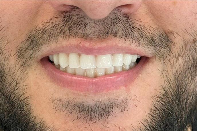 caso-clinico-8-depois