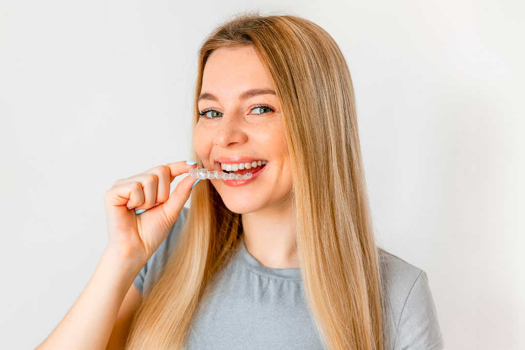 aligneurs invisibles